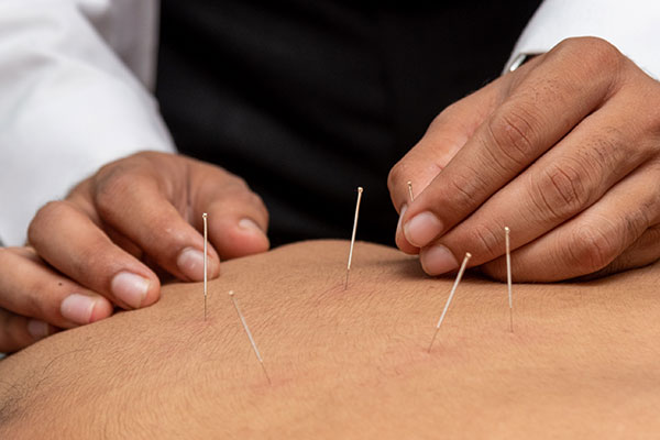 Patanjali acupuncture therapy