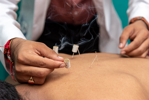 Patanjali Acupuncture